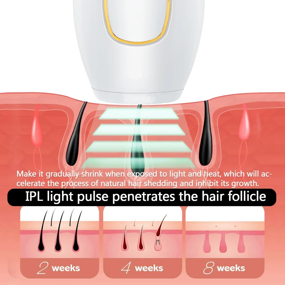 IPL Hair Removal Device